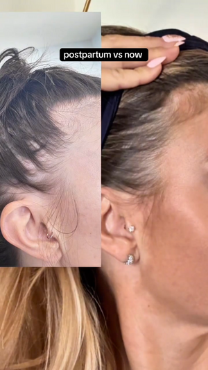 LumiHeal Pro Hair Growth Massager(3).png